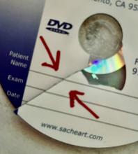  DVD FAILURES A SAD STORY